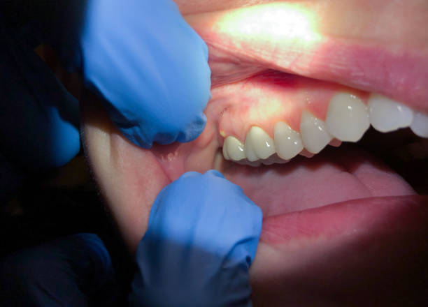 Best Emergency Pediatric Dental Care in East Aurora, NY